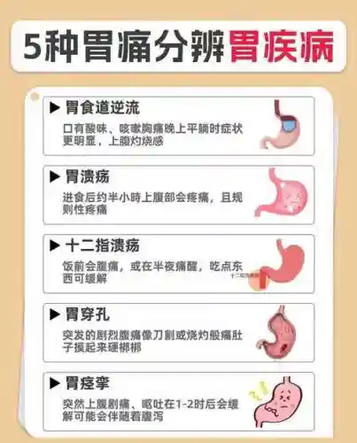 胃部阵容插图